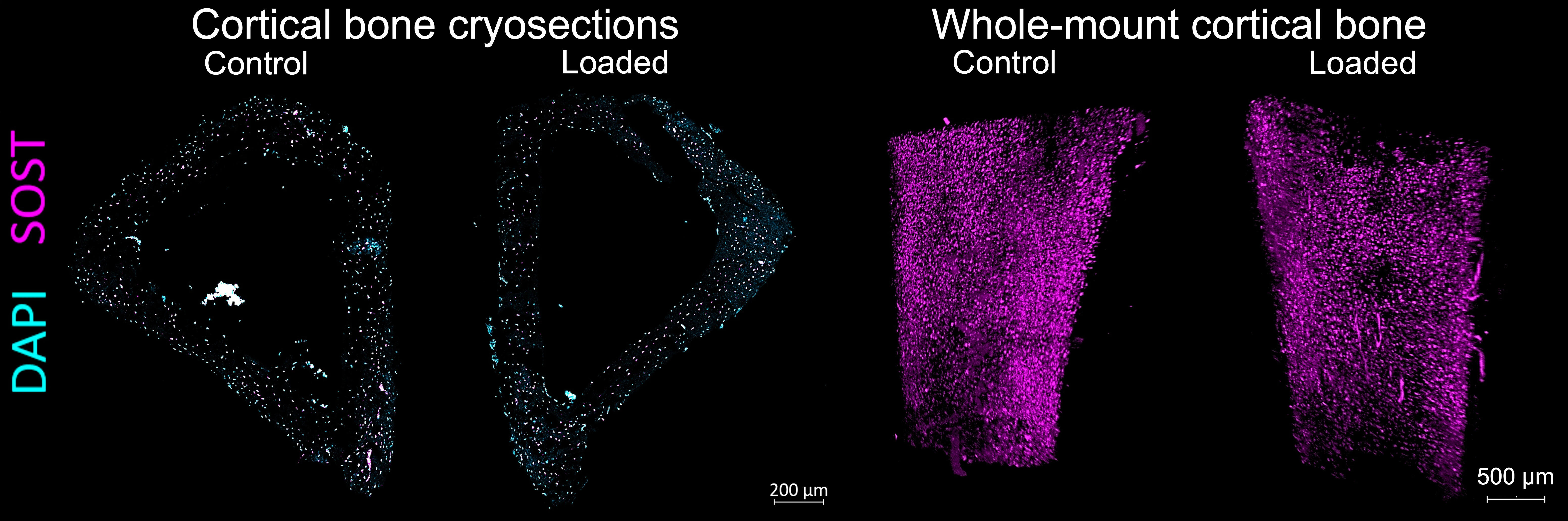 Molecular imaging of sclerostin, which is labelled in magenta and shows up as small dots all over the bone in 3D.